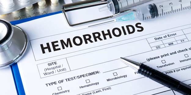 Best Hemorrhoid Surgery in Orange County - Orange County Hemorrhoid Clinic