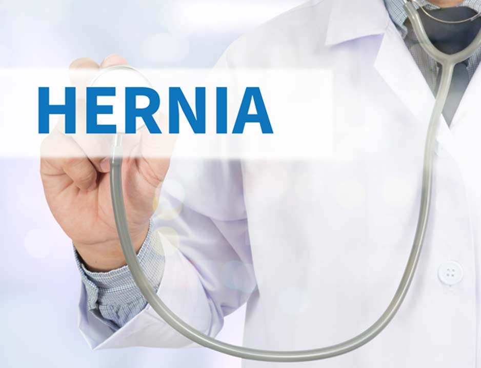 medical-concept-of-inguinal-hernia-OC-Hemorrhoid-Clinic