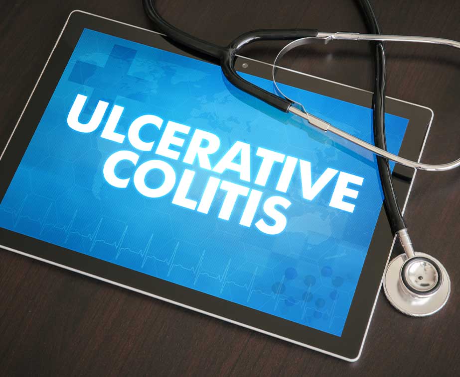 Ulcerative-colitis-OC-Hemorrhoid-Clinic-2